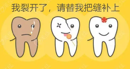 补牙多少钱一颗牙(补牙多少钱一颗牙洞)