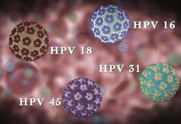 打了两针才发现自己HPV感染