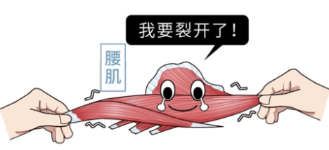腰肌劳损治疗最佳方法(腰肌劳损治疗最佳方法知乎)