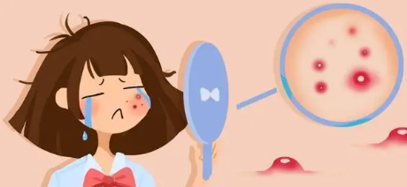 下巴长痘痘是什么原因(下巴长痘痘是什么原因男)